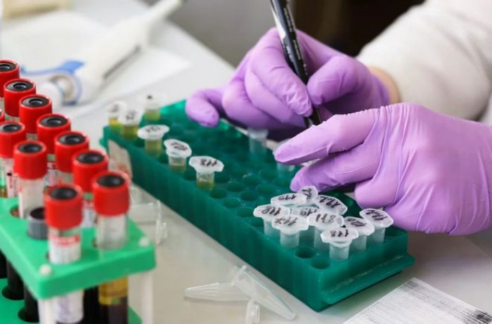 Al via i test sierologici in tutta Italia, il piano delle Regioni per stabilire quanti hanno contratto il virus Al via i test sierologici in tutta Italia, il piano delle Regioni per stabilire quanti hanno contratto il virus