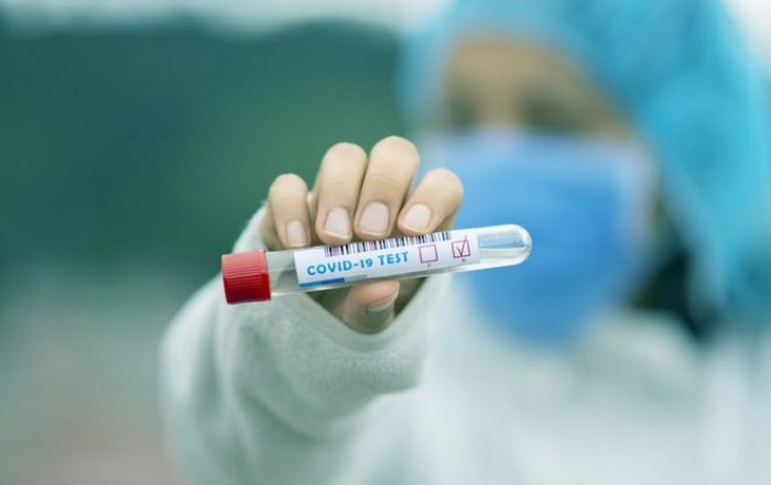 Dopo il flop dell'app Immuni, la strategia anti-Covid fallisce anche nel campo dei test sierologici Dopo il flop dell'app Immuni, la strategia anti-Covid fallisce anche nel campo dei test sierologici