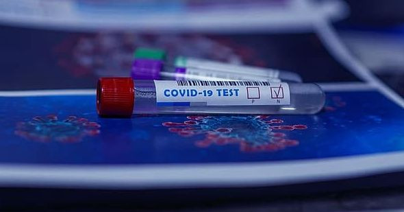 Coronavirus, arrivano i test Coronavirus, arrivano i test