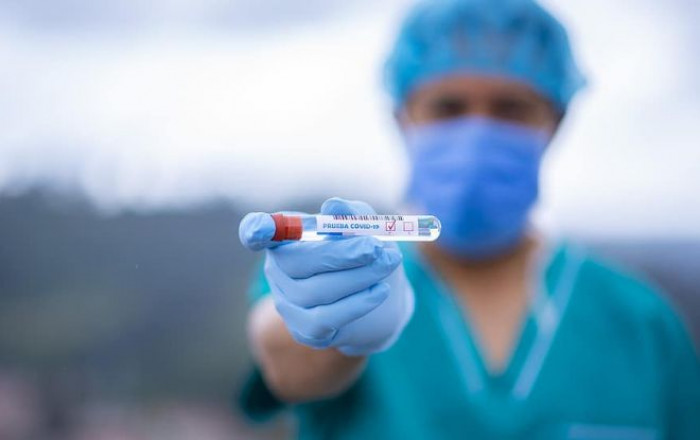 Coronavirus Veneto, in arrivo test fai da te in tutte le farmacie Coronavirus Veneto, in arrivo test fai da te in tutte le farmacie