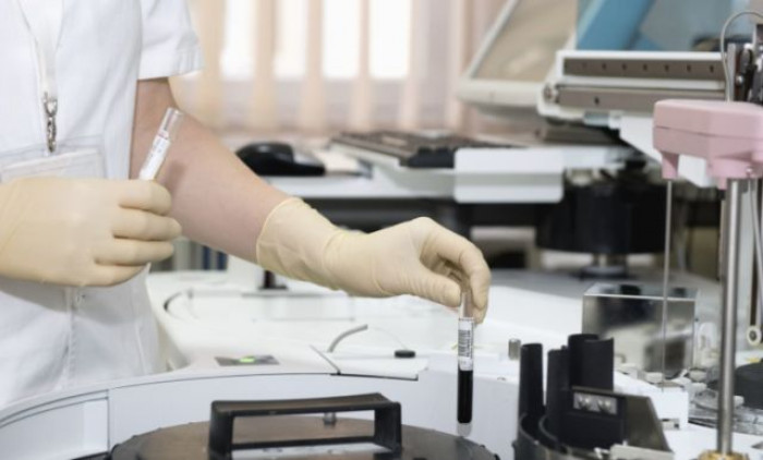 Sicilia, tre decessi dopo la somministrazione del vaccino Oxford-AstraZeneca Sicilia, tre decessi dopo la somministrazione del vaccino Oxford-AstraZeneca