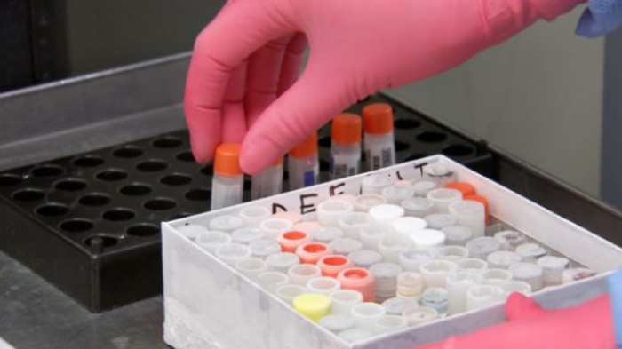 Covid-19, casi di reinfezione in soggetti vaccinati e con un alto titolo anticorpale Covid-19, casi di reinfezione in soggetti vaccinati e con un alto titolo anticorpale