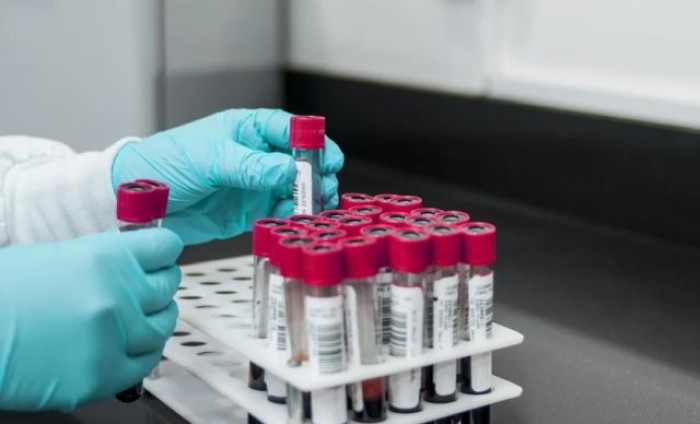 India, nuova epidemia legata all'infezione da India, nuova epidemia legata all'infezione da