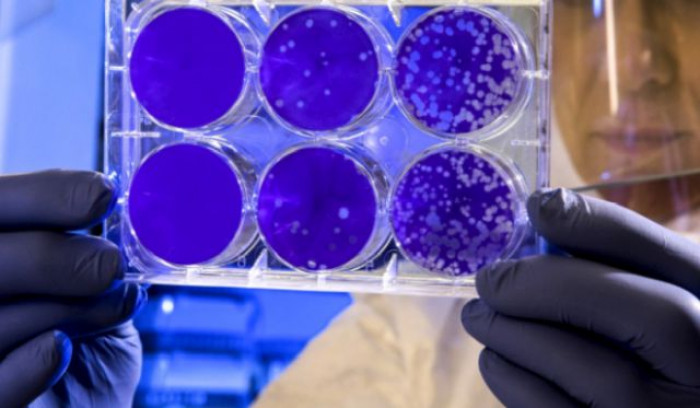 Nuova pillola Pfizer contro il Covid-19: ecco l'efficacia e il costo di distribuzione di Paxlovid Nuova pillola Pfizer contro il Covid-19: ecco l'efficacia e il costo di distribuzione di Paxlovid